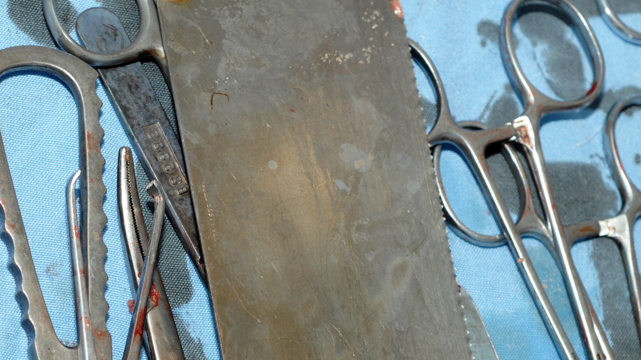 Rosja z sowieckimi praktykami. Młodej kobiecie amputowano ręce