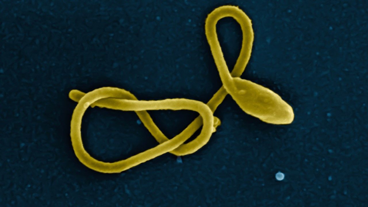 Cząsteczka wirusa ebola (fot. IMAGE POINT FR/NIH/NIAID/BSIP/Universal Images Group via Getty Images) Cząsteczka wirusa ebola (fot. IMAGE POINT FR/NIH/NIAID/BSIP/Universal Images Group via Getty Images)