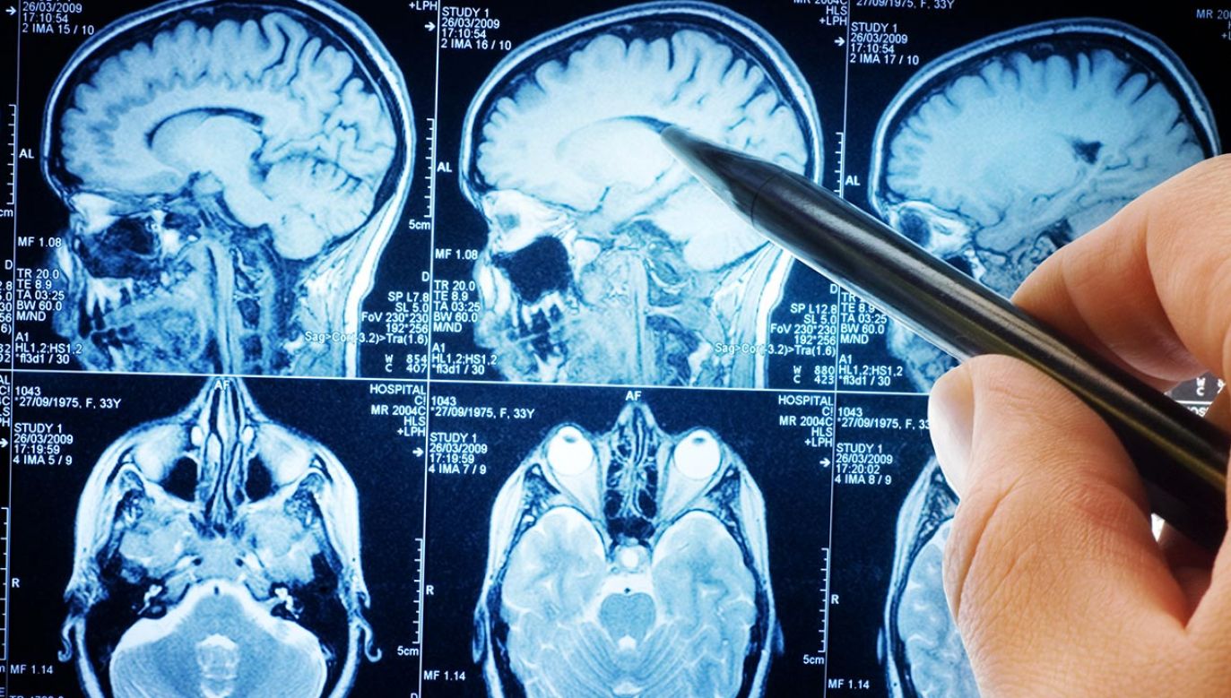 Ludzki mózg powoli odsłania swoje tajemnice (fot. Shutterstock/Triff)